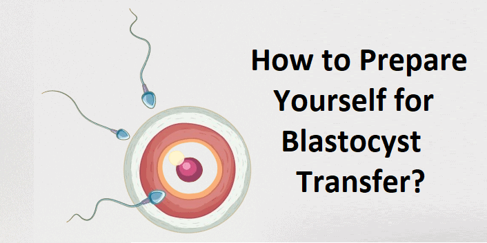 How to Prepare Yourself for Blastocyst Transfer?