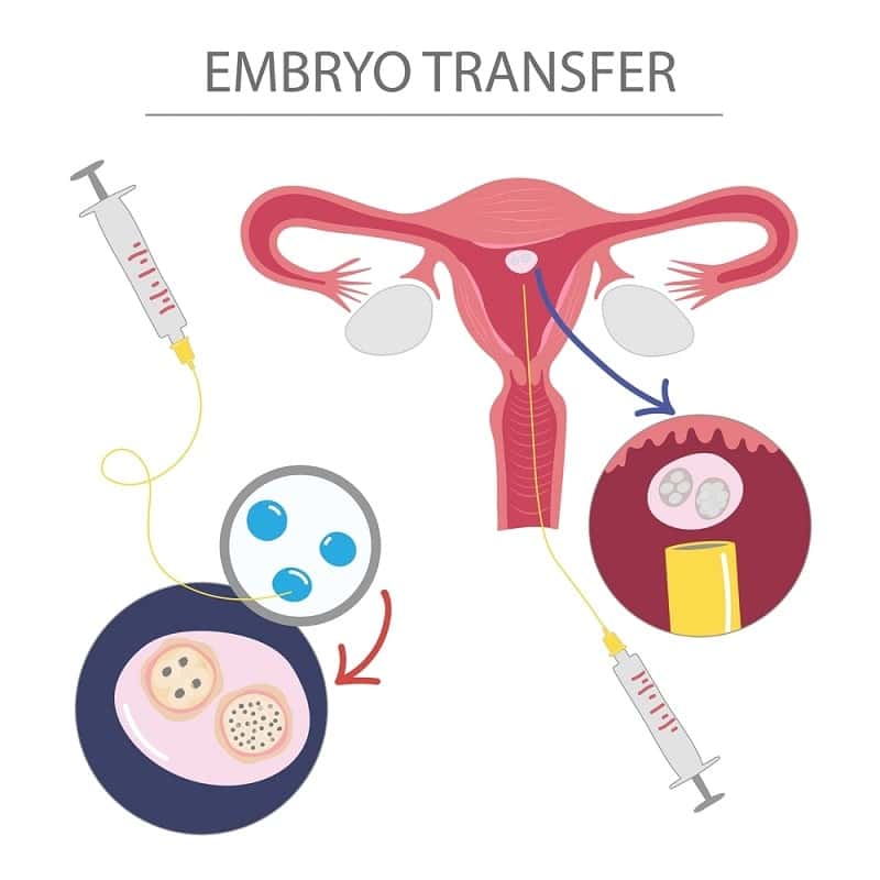 The Ultimate Guide to IVF Financing: Understanding Your Options